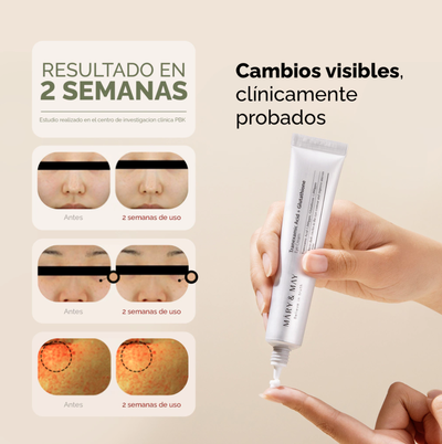 TRANEXAMIC ACID + GLUTATHIONE EYE CREAM 